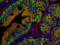 beta-Catenin Antibody, Novus Biologicals 0.1mg; Unlabeled:Antibodies, Polyclonal