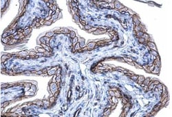 beta-Catenin Antibody, Novus Biologicals 0.1mg; Unlabeled:Antibodies, Polyclonal