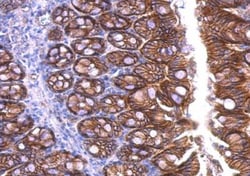 beta-Catenin Antibody, Novus Biologicals 0.1mg; Unlabeled:Antibodies, Polyclonal