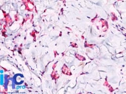 beta-Catenin Antibody, Novus Biologicals 20 &mu;g, Unlabeled:Antikörper