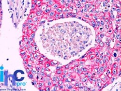 beta-Catenin Antibody, Novus Biologicals 20 &mu;g, Unlabeled:Antikörper