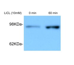 beta-Catenin Antibody, Novus Biologicals 0.1mg; Unlabeled:Antibodies, Polyclonal