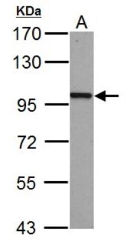 beta-Catenin Antibody, Novus Biologicals 0.1mg; Unlabeled:Antibodies, Polyclonal