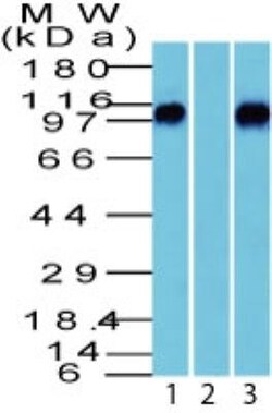 beta-Catenin Antibody, Novus Biologicals 20 &mu;g, Unlabeled:Antikörper