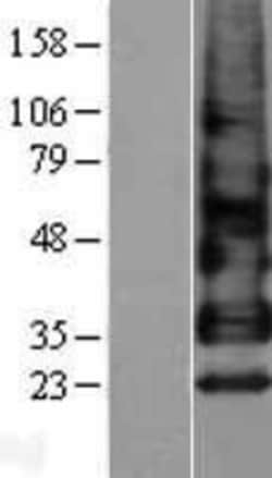 Novus Biologicals&trade;&nbsp;Betacellulin/BTC Overexpression Lysate
