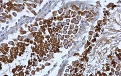 beta COP Antibody, Novus Biologicals 0.1mL; Unlabeled:Antibodies, Polyclonal