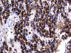 beta-Galactosidase-1/GLB1 Antibody (OTI1C9), Novus Biologicals 0.1mL; Unlabeled:Antibodies,