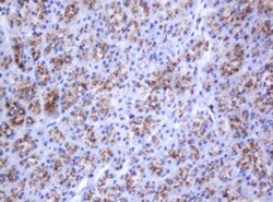 beta-Galactosidase-1/GLB1 Antibody (OTI1C9), Novus Biologicals 0.1mL; Unlabeled:Antibodies,