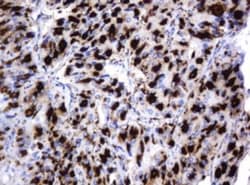 beta-Galactosidase-1/GLB1 Antibody (OTI1C9), Novus Biologicals 0.1mL; Unlabeled:Antibodies,