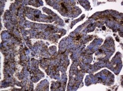 beta-Galactosidase-1/GLB1 Antibody (OTI1C9), Novus Biologicals 0.1mL; Unlabeled:Antibodies,