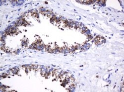 beta-Galactosidase-1/GLB1 Antibody (OTI1C9), Novus Biologicals 0.1mL; Unlabeled:Antibodies,