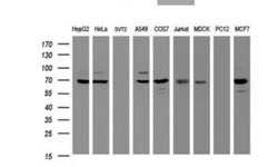 beta-Galactosidase-1/GLB1 Antibody (OTI1C9), Novus Biologicals 0.1mL; Unlabeled:Antibodies,