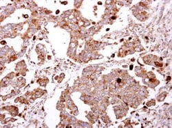 beta-Galactosidase-1/GLB1 Antibody, Novus Biologicals 0.1mg; Unlabeled:Antibodies,