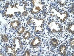 beta-Glucuronidase/GUSB Antibody, Novus Biologicals 0.1mg; Unlabeled:Antibodies,