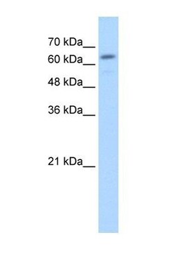 beta-Glucuronidase/GUSB Antibody, Novus Biologicals 0.1mg; Unlabeled:Antibodies,