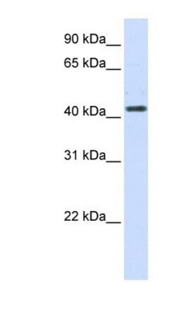 Beta Hydroxysteroid Dehydrogenase Antibody, Novus Biologicals 0.05mg; Unlabeled:Antibodies,