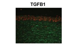 Beta Ig-h3/TGFBI Antibody, Novus Biologicals 0.1mg; Unlabeled:Antibodies,