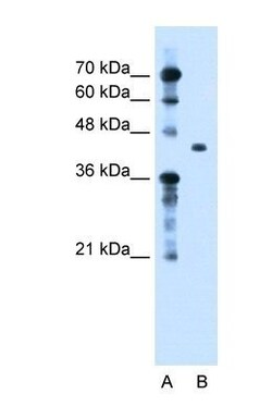 Beta Ig-h3/TGFBI Antibody, Novus Biologicals 0.1mg; Unlabeled:Antibodies,