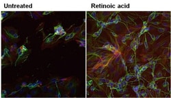 beta-III Tubulin Antibody (2G10), Novus Biologicals 0.02mL; Unlabeled:Antibodies,