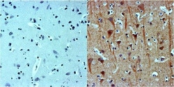 beta-III Tubulin Antibody (2G10), Novus Biologicals 0.02mL; Unlabeled:Antibodies,