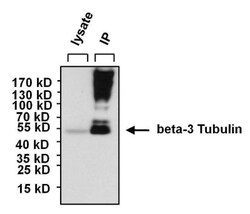 beta-III Tubulin Antibody (2G10), Novus Biologicals 0.02mL; Unlabeled:Antibodies,