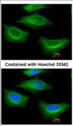 beta II Tubulin A Antibody, Novus Biologicals 0.1mL; Unlabeled:Antibodies,