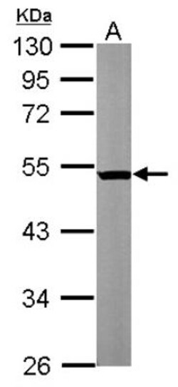 beta II Tubulin A Antibody, Novus Biologicals 0.1mL; Unlabeled:Antibodies,