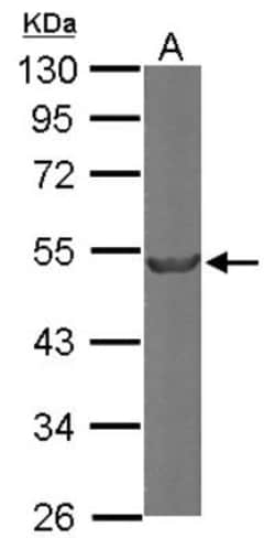 beta II Tubulin A Antibody, Novus Biologicals 0.1mL; Unlabeled:Antibodies,