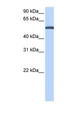 LACTB Antibody, Novus Biologicals 100&mu;L; Unlabeled:Antibodies, Polyclonal