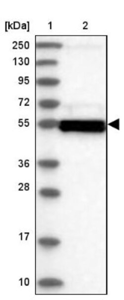 LACTB Antibody, Novus Biologicals 25 &mu;L; Unlabeled:Antibodies, Polyclonal