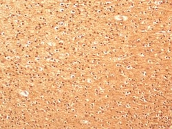 beta Tubulin Antibody - BSA Free, Novus Biologicals 0.025mL; Unlabeled:Antibodies,