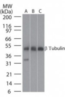 beta Tubulin Antibody, Novus Biologicals:Antibodies:Primary Antibodies