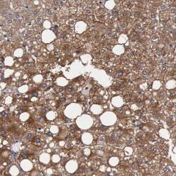 beta ureidopropionase Antibody, Novus Biologicals 0.1mL; Unlabeled:Antibodies,