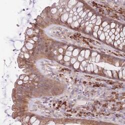 BEX2 Antibody, Novus Biologicals 0.1mL; Unlabeled:Antibodies, Polyclonal