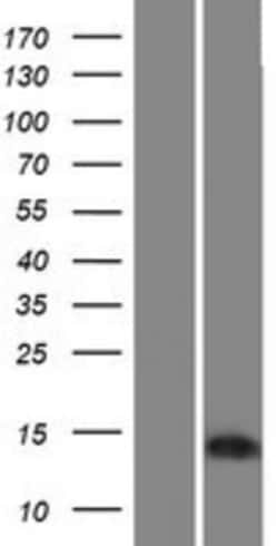 Novus Biologicals BEX4 Overexpression Lysate 0.1 mg | Buy Online | Novus Biologicals&trade; | Fisher Scientific