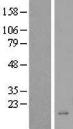 Novus Biologicals&trade;&nbsp;BEX5 Overexpression Lysate