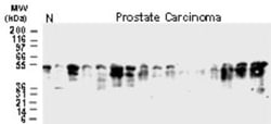 BFAR Antibody, Novus Biologicals 0.05mL; Unlabeled:Antibodies, Polyclonal