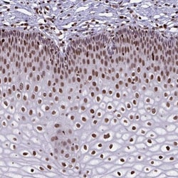 BHLHA9 Antibody, Novus Biologicals 0.1mL; Unlabeled:Antibodies, Polyclonal
