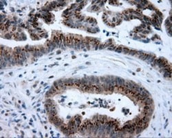 BHMT Antibody (OTI3E11), Novus Biologicals 0.1mL; Unlabeled:Antibodies,
