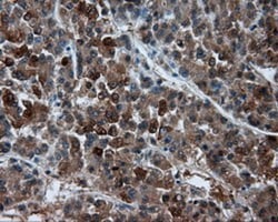 BHMT Antibody (OTI3E11), Novus Biologicals 0.1mL; Unlabeled:Antibodies,