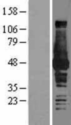 Novus Biologicals&trade;&nbsp;BHMT Overexpression Lysate