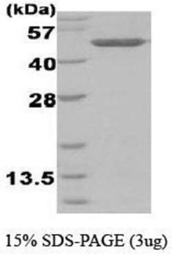 Novus Biologicals&trade;&nbsp;Recombinant Human BHMT His Protein