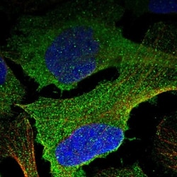 BHMT2 Antibody, Novus Biologicals:Antibodies:Primary Antibodies