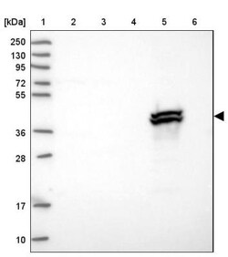 BHMT2 Antibody, Novus Biologicals:Antibodies:Primary Antibodies