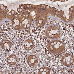 BICD1 Antibody, Novus Biologicals:Antibodies:Primary Antibodies