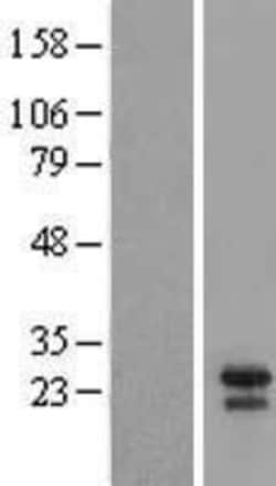 Novus Biologicals BID Overexpression Lysate 0.1 mg | Buy Online | Novus Biologicals&trade; | Fisher Scientific
