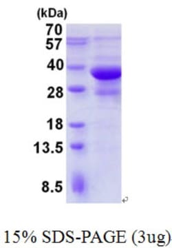 Novus Biologicals&trade;&nbsp;Recombinant Human Endophilin B1/Bif-1 His Protein