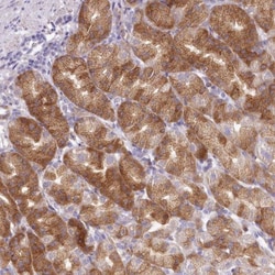 BIG3 Antibody, Novus Biologicals 25 &mu;L | Buy Online | Novus Biologicals | Fisher Scientific