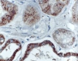 BIK Antibody, Novus Biologicals 0.025mL; Unlabeled:Antibodies, Polyclonal
