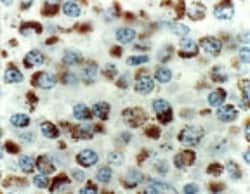 BIK Antibody, Novus Biologicals 0.025mL; Unlabeled:Antibodies, Polyclonal